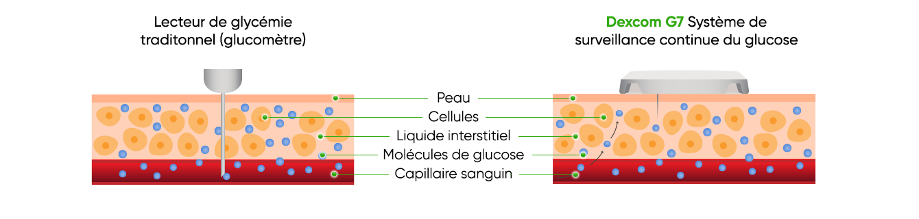 Cross-section of skin showing the differences between a BGM  fingerstick test depth and CGM sensor filament depth.